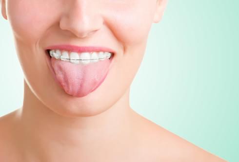 keeping your tongue clean and healthy enhances your orthodontic treatment