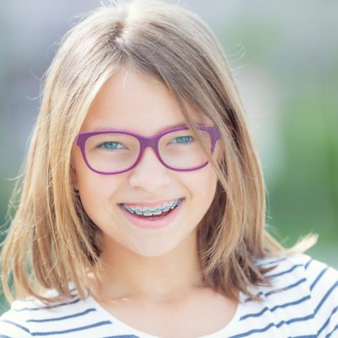 does my kid need braces? here’s what to look for
