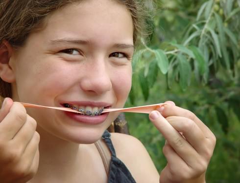 chewing the right type of gum during orthodontic treatment can help decrease cavities!